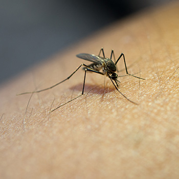zika virus baby defect
